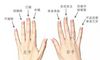 男性和女性戒指纠正DAI方法
